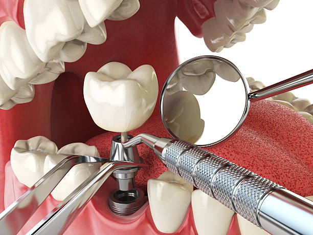 Best Emergency Treatment for Toothache in Nibley, UT