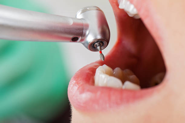 Best Walk-In Emergency Dentist in Nibley, UT